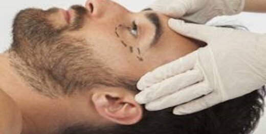 رضایت همسر برای عمل جراحی زیبایی و غیرزیبایی مهم است؟/قانون چه میگوید؟